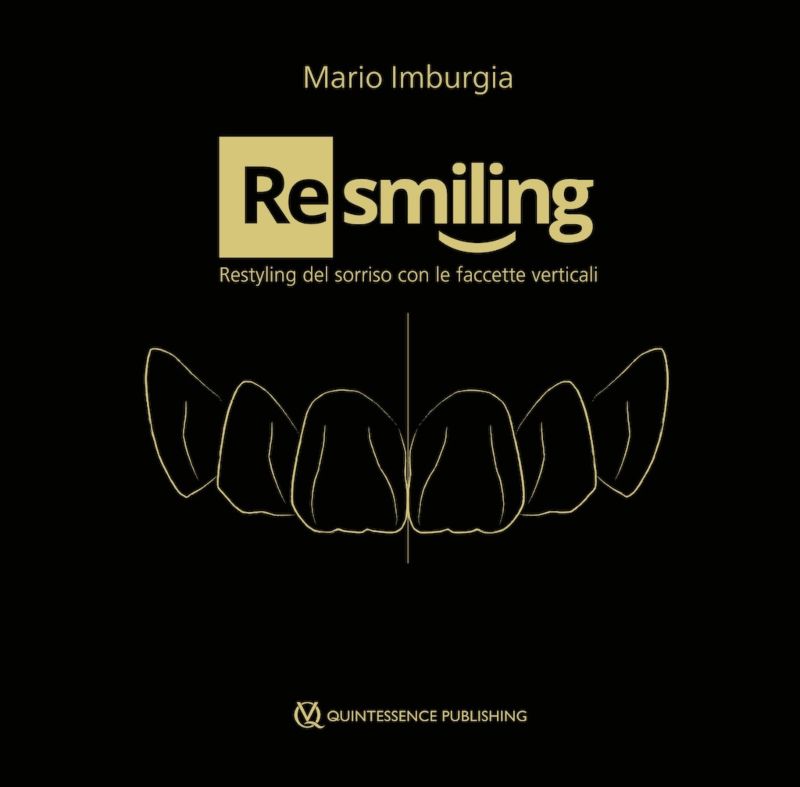 (Re)smiling Restyling del sorriso con le faccette verticali