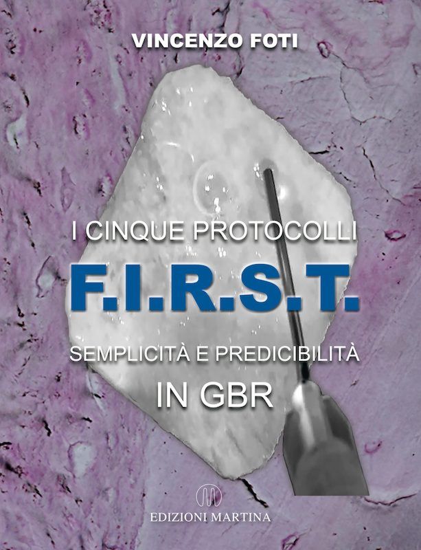 I Cinque Protocolli F.I.R.S.T  Semplicità e Predicibilità in GBR