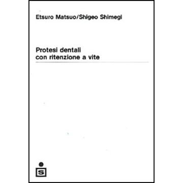 Protesi dentali con ritenzioni a vite