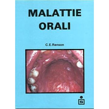 Malattie orali - Atlante a colori
