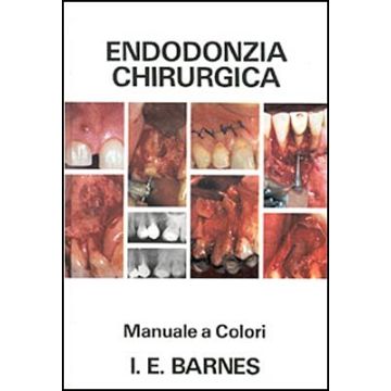 Endodonzia chirurgica - Manuale a colori