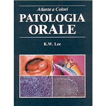 Patologia orale - Atlante a colori