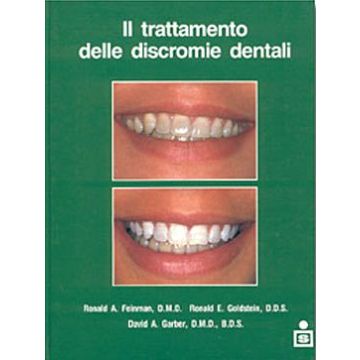Il trattamento delle discromie dentali
