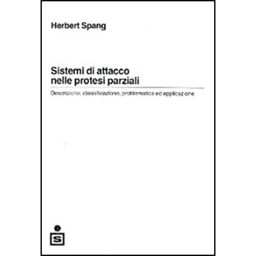 Sistemi di attacco nelle protesi parziali - Descrizione, classificazione, problematica ed applicazione