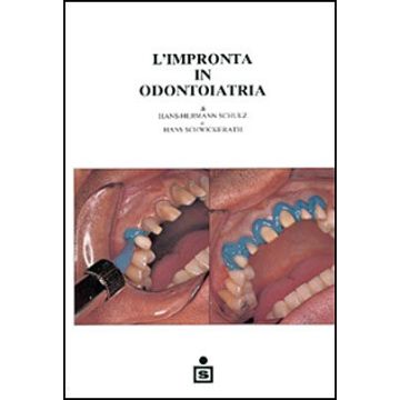 L' impronta in odontoiatria