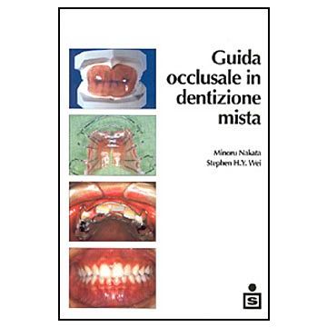 Guida occlusale in dentizione mista