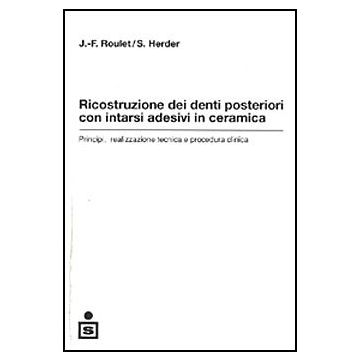 Ricostruzione dei denti posteriori con intarsi adesivi in ceramica - Principi, realizzazione, tecnica e procedura clinica