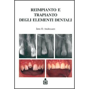 Reimpianto e trapianto degli elementi dentali