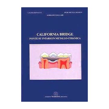 California Bridge - Ponte su intarsi in metallo - ceramica