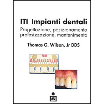 ITI - Impianti dentali - Progettazione, posizionamento, protesizzazione, mantenimento