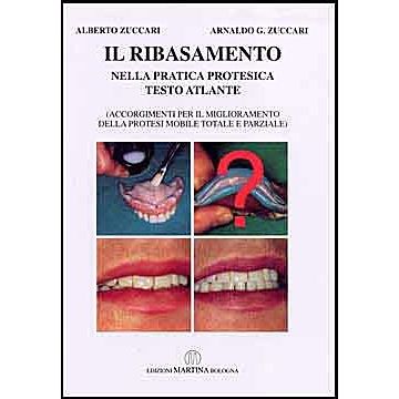 Il Ribasamento - nella pratica protesica - Testo Atlante