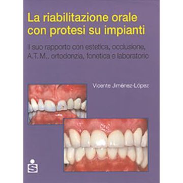 La riabilitazione orale con protesi su impianti - In relazione con estetica, occlusione, ATM, ortodonzia, fonetica e laboratorio