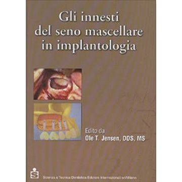 Gli innesti del seno mascellare in implantologia