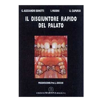 Il disgiuntore rapido del palato