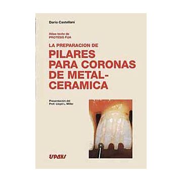 Atlas-texto de Protesis Fija - La preparacion de Pilares para coronas de metal-ceramica