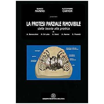 La Protesi Parziale Rimovibile dalla teoria alla pratica