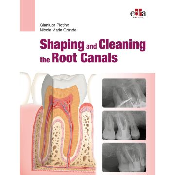 Shaping and Cleaning the Root Canals