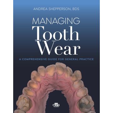 Managing tooth Wear. A comprehensive guide for general practice
