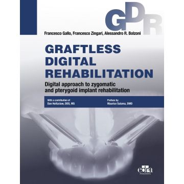 Graftless digital rehabilitation, gdr. Digital approach to zygomatic and pterygoid implant rehabilitation. Con QR Code