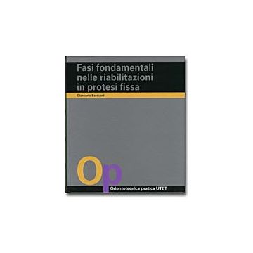 Fasi fondamentali nelle riabilitazioni in protesi fissa