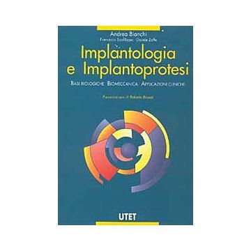 Implantologia e implantoprotesi - Basi biologiche - Biomeccanica - Applicazioni cliniche