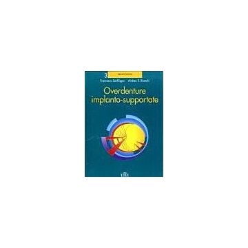 Overdenture implanto-supportate - Protesi su impianti