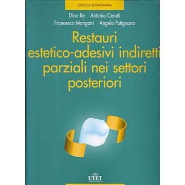 Restauri estetico-adesivi indiretti parziali nei settori posteriori