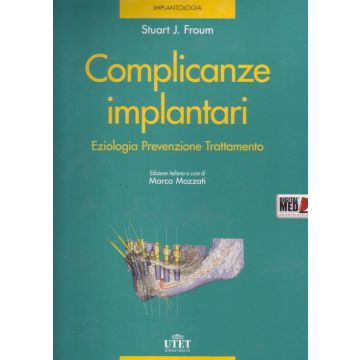 Complicanze Implantari - Eziologia Prevenzione Trattamento - Con DVD e Micro SD