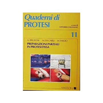 Preparazioni parziali in protesi fissa - n. 11
