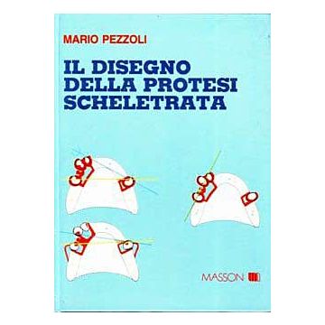 Il disegno della protesi scheletrata 