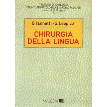 Chirurgia della lingua