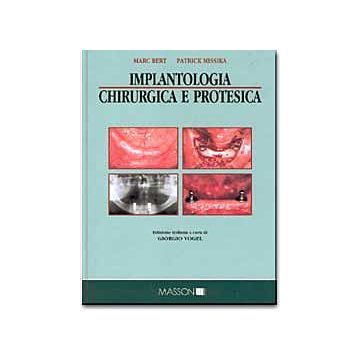 Implantologia chirurgica e protesica