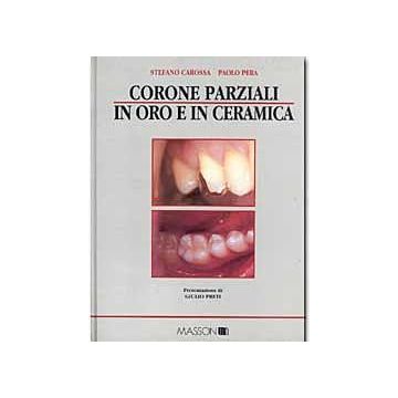 Corone parziali in oro e in ceramica