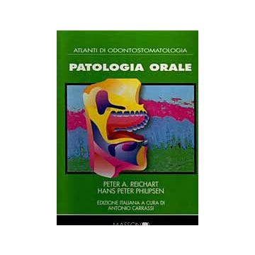 Patologia orale - Atlante di odontostomatologia