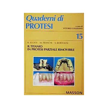 Il titanio in protesi parziale rimovibile - n. 15
