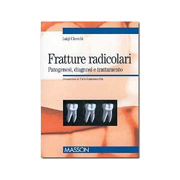 Fratture radicolari - Patogenesi, diagnosi e trattamento