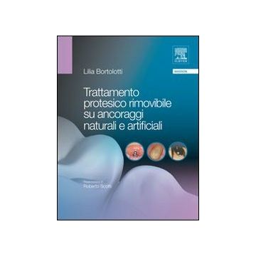 Trattamento protesico rimovibile su ancoraggi naturali e artificiali