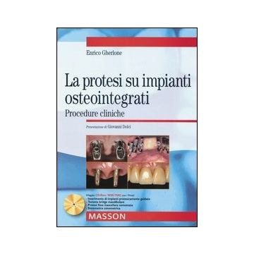 La protesi su impianti osteointegrati - PROCEDURE CLINICHE + CD Rom
