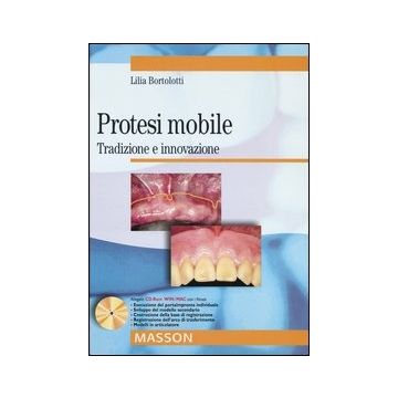 Protesi mobile - Tradizione e innovazione + CD Rom