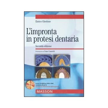 L' impronta in protesi dentaria 2/ed.