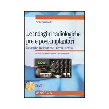 Le indagini radiologiche pre e post-implantari. Metodiche di esecuzione, errori, lettura + CD