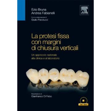 La Protesi Fissa con margini di chiusura verticali. Un approccio razionale alla clinica e al laboratorio + DVD