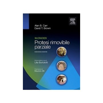 McCRACKEN - Protesi rimovibile parziale 12/ed.