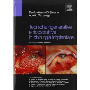 Tecniche Rigenerative e Ricostruttive in chirurgia implantare