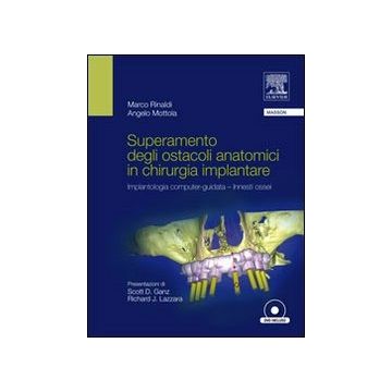Superamento degli ostacoli anatomici in Chirurgia Implantare - Implantologia Computer-Guidata - Innesti ossei + DVD