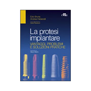 La protesi implantare