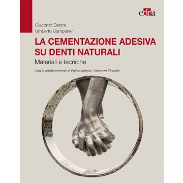 La Cementazione adesiva su denti naturali. Materiali e tecniche
