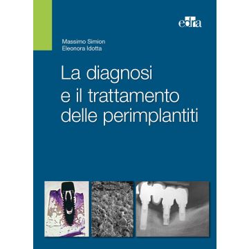 La diagnosi e il trattamento delle perimplantiti