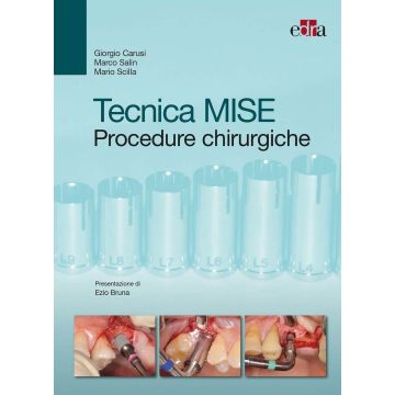 Tecnica MISE - Procedure chirurgiche