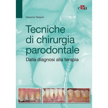 Tecniche di Chirurgia Parodontale - Dalla diagnosi alla terapia